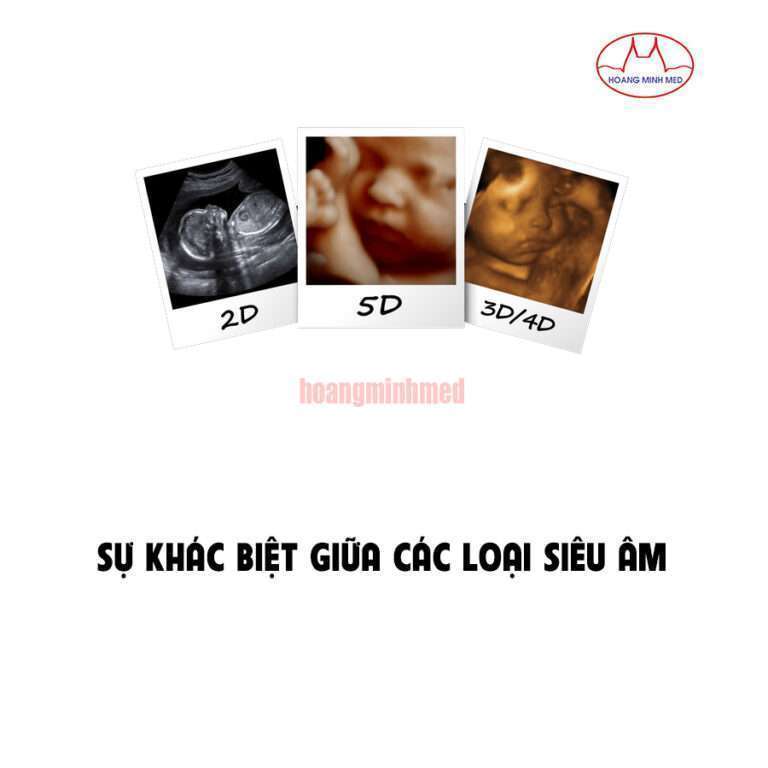 Sự khác biệt giữa các loại siêu âm