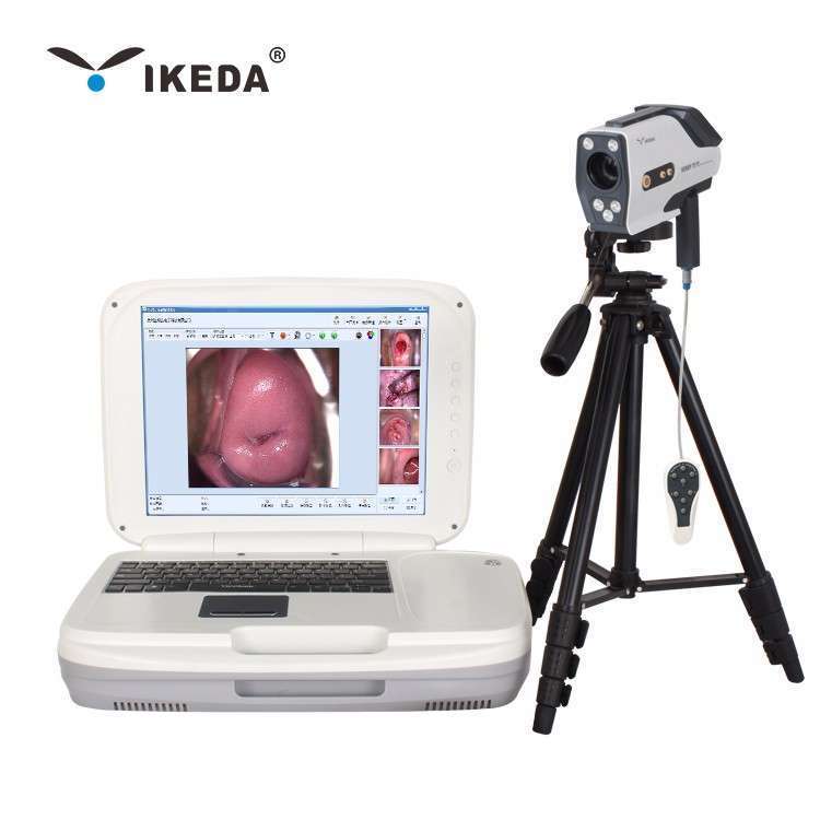 1985-202011121506592803-2 Hình ảnh soi cổ tử cung tốt Máy ảnh soi cổ tử cung HD,giá thấp Hình ảnh soi cổ tử cung tốt Máy ảnh soi cổ tử cung HD Purchasing