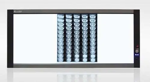 Đèn Đọc Phim 3 Cửa X-Quang Mplent ZG-3B