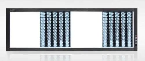 Đèn Đọc Phim 4 Cửa X-Quang Mplent ZG-4B