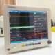 Monitor theo dõi bệnh nhân đa thông số HWATIME H8