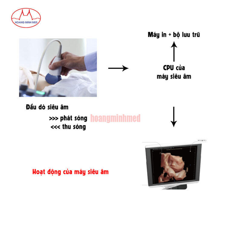 Tìm hiểu về hoạt động của máy siêu âm