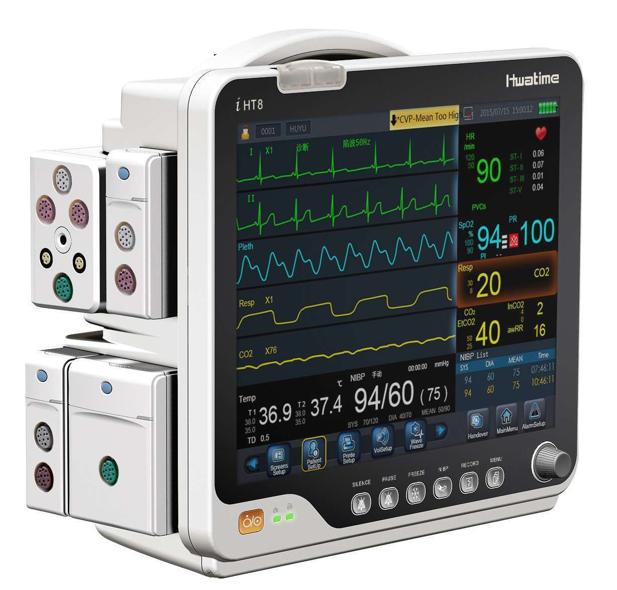 monitor-1