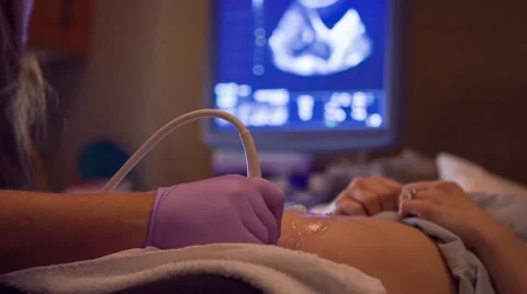Pregnant Woman Getting Ultrasound Stock Footage ~ Royalty Free Stock Videos  | Pond5