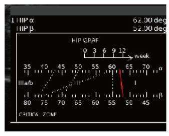 qbit53