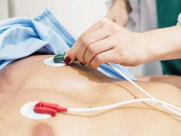 Đo ECG