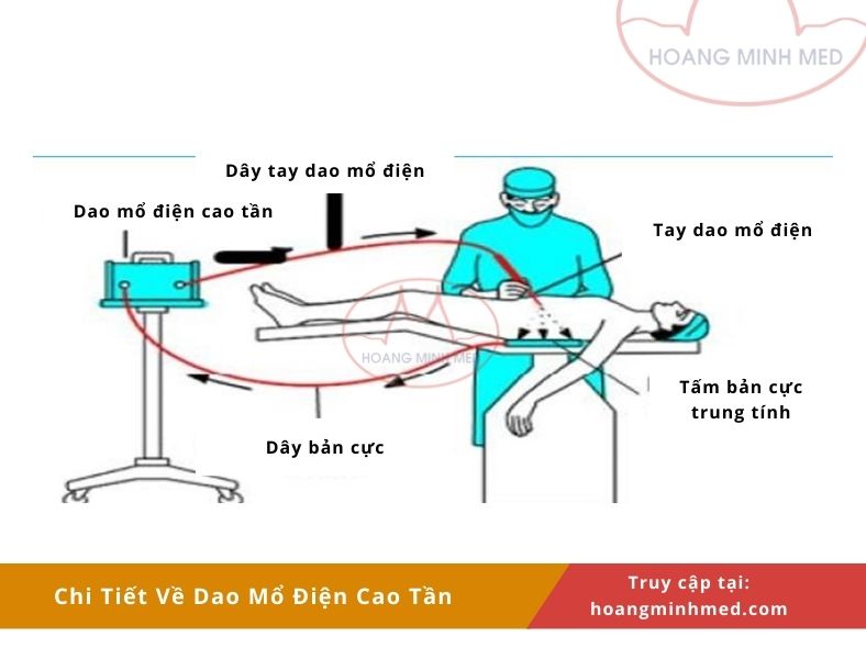Chi Tiết Về Dao Mổ Điện Cao Tần Và Top 5 Sản Phẩm Phổ Biến