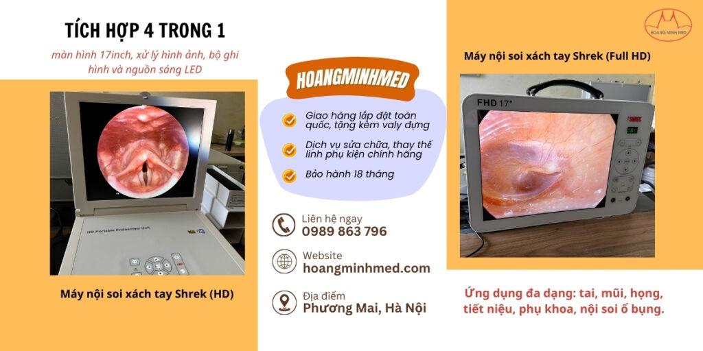 Máy nội soi tai mũi họng xách tay Shrek chính hãng