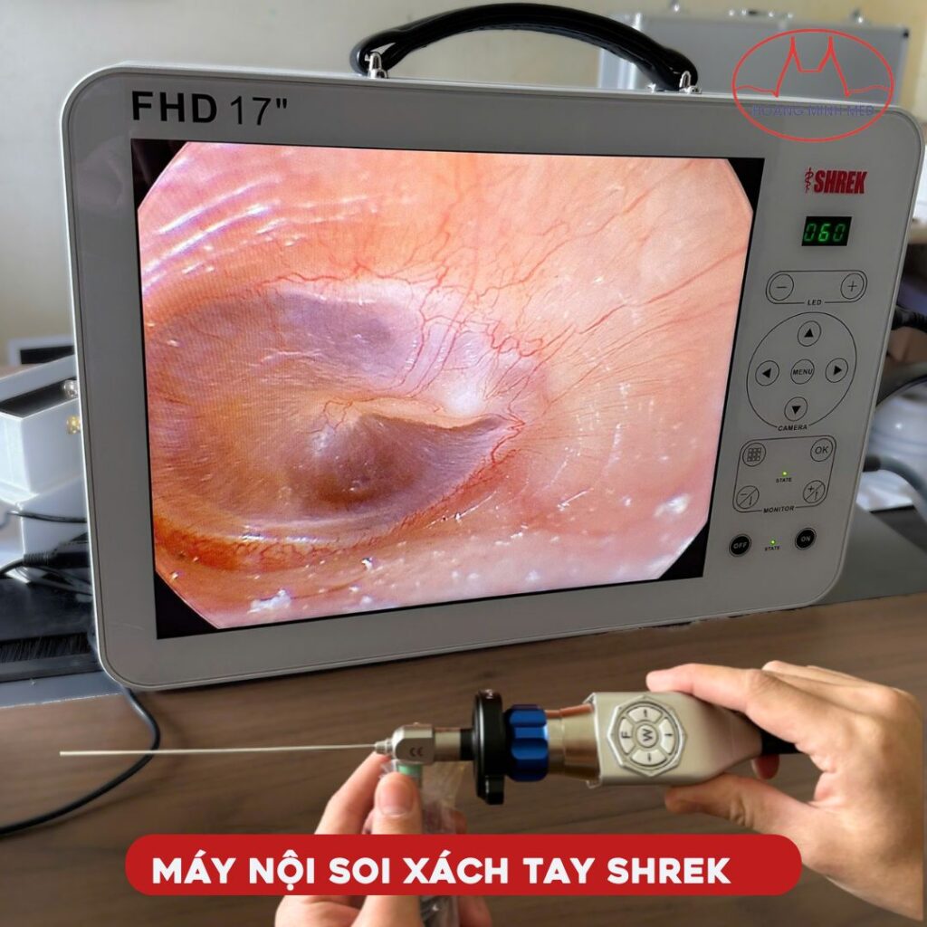 Máy nội soi tai mũi họng xách tay Shrek chất lượng Full HD