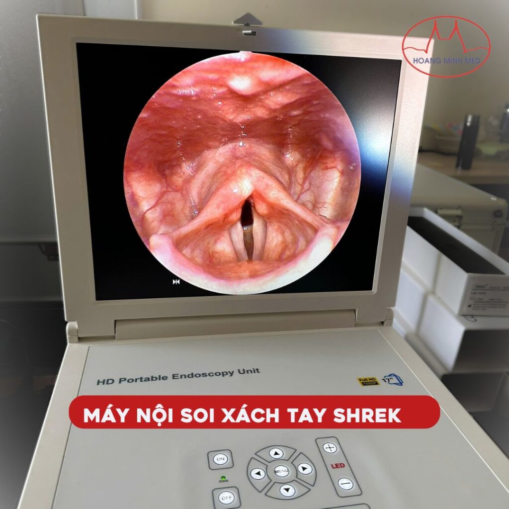 Máy nội soi tai mũi họng xách tay Shrek chất lượng HD