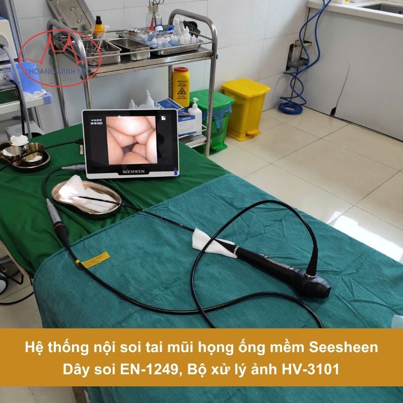 Ưu điểm nổi bật của hệ thống nội soi tai mũi họng ống mềm SeeSheen