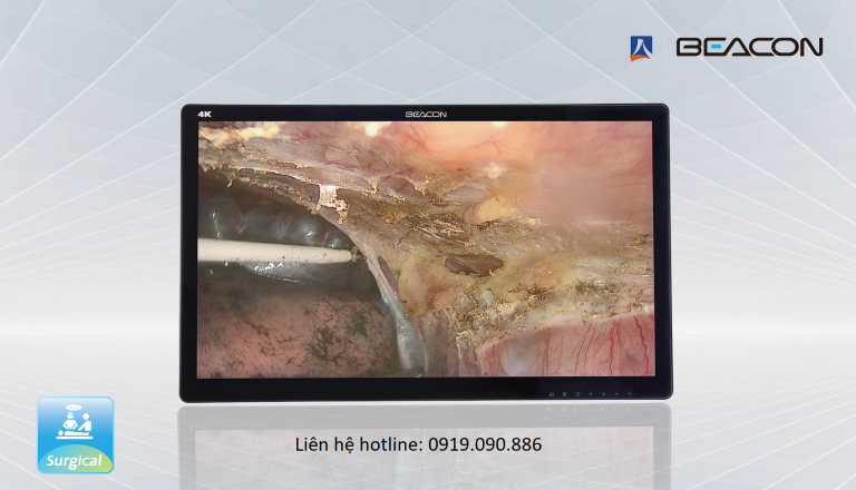 Màn Hình Phẫu Thuật Y Tế 4K BEACON S2785P